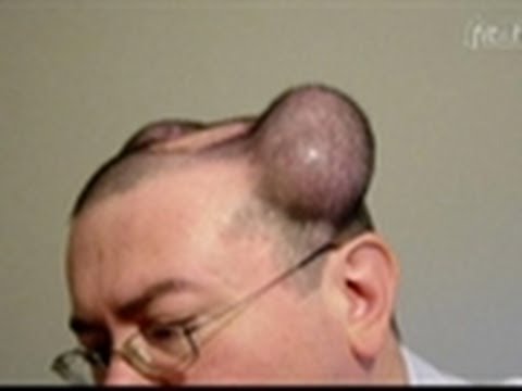 Watch Bizarre ER - Balloons in the Head | Bizarre ER Online
