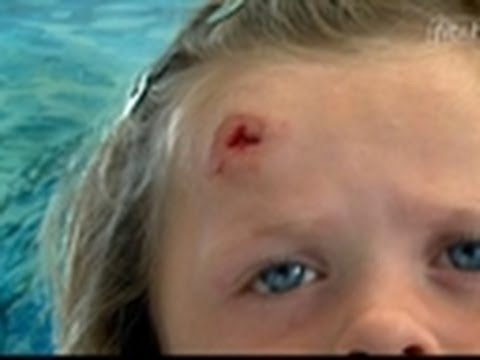 Watch Bizarre ER - Folded Sandwich | Bizarre ER Online
