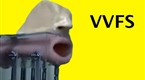 Watch infoMania - YouTube's Scariest Robots Online