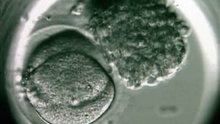 Watch NBC Nightly News with Brian Williams - New IVF Technology Offers Dramatic Results Online