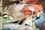 Watch One Born Every Minute Season 2 Episode 3 - The Heart to Survive  Online