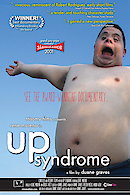 Up Syndrome